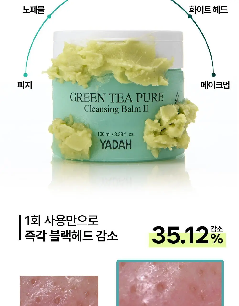 [블랙헤드제거] 야다 그린 티 퓨어 클렌징 밤 100ml 상세페이지 25